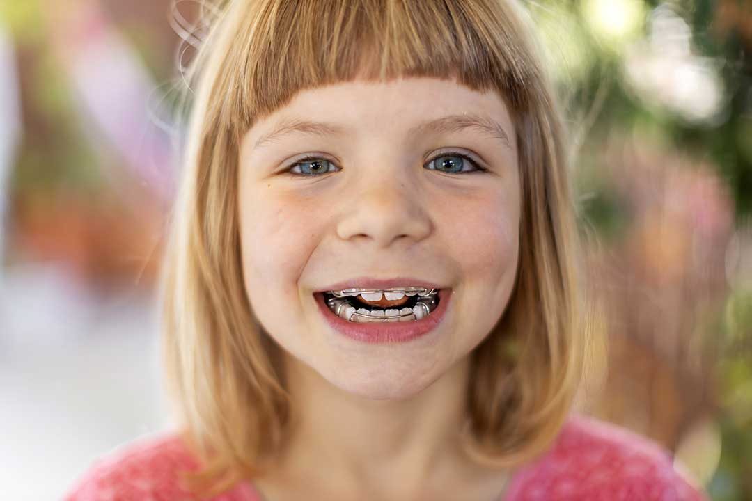 When should I bring my child to an orthodontist?