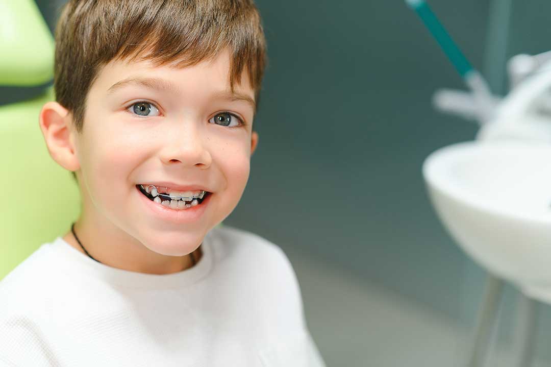 When is the right time for your child to get braces?