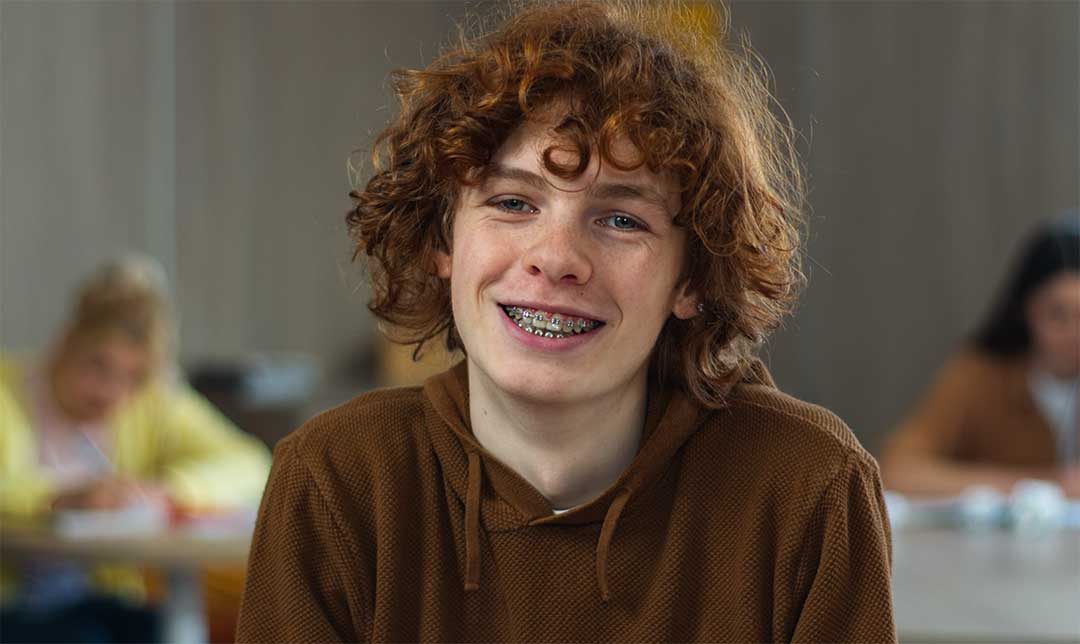 Is 2 Years of Braces a Lot?