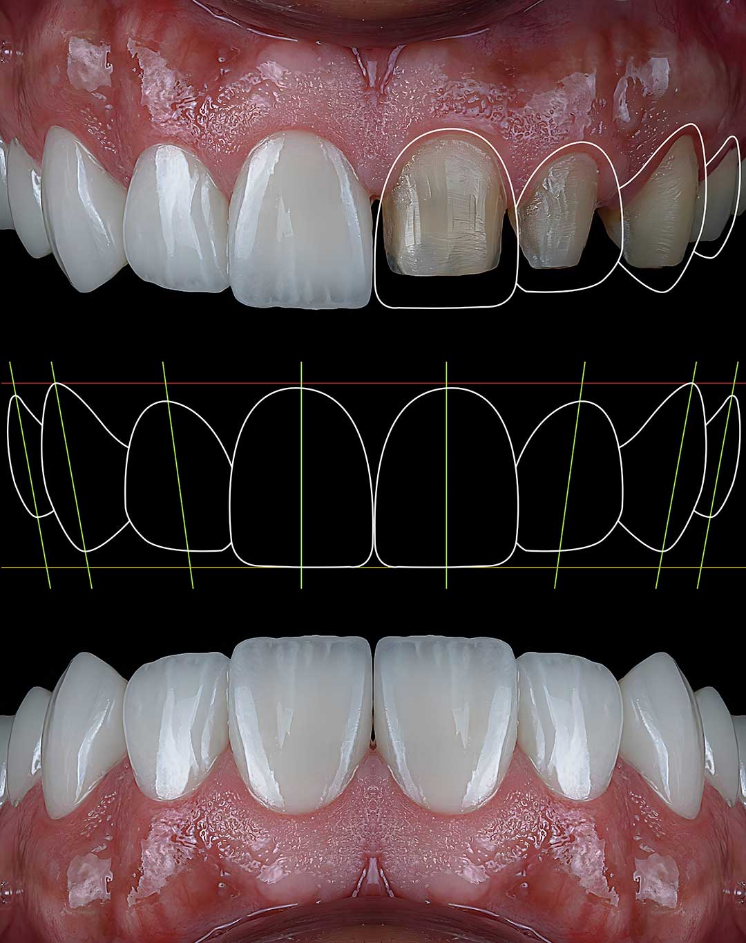 Digital Smile Design