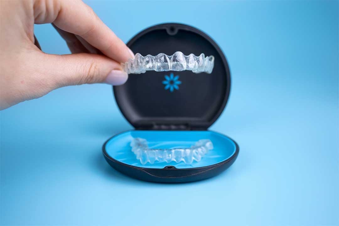 Invisaign Clear Aligners