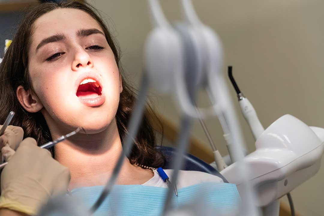 Why Some People Never Develop Wisdom Teeth