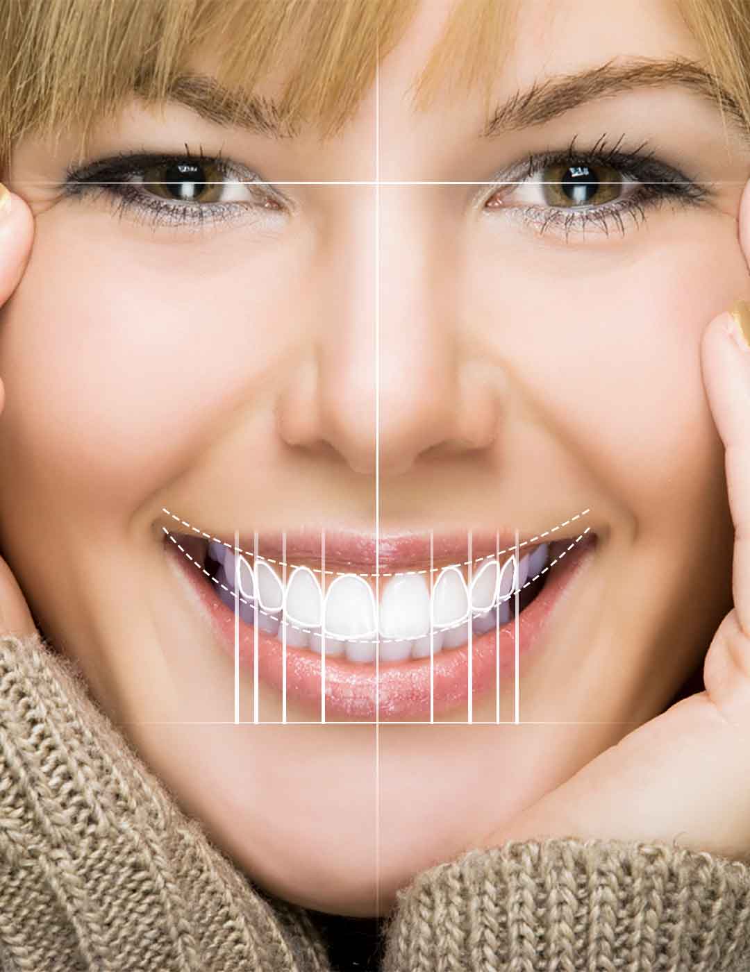 Digital Smile Design
