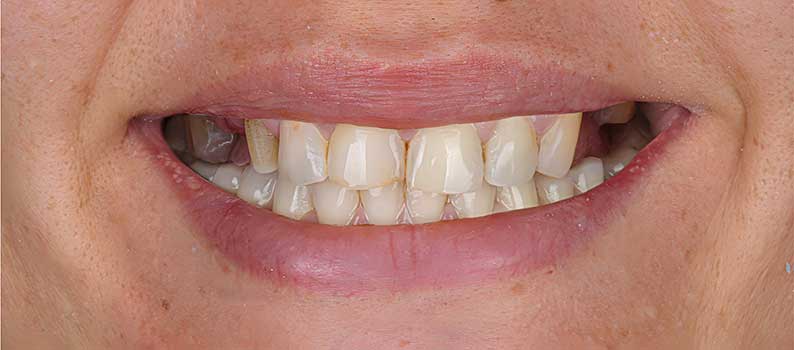 Digital Smile Design