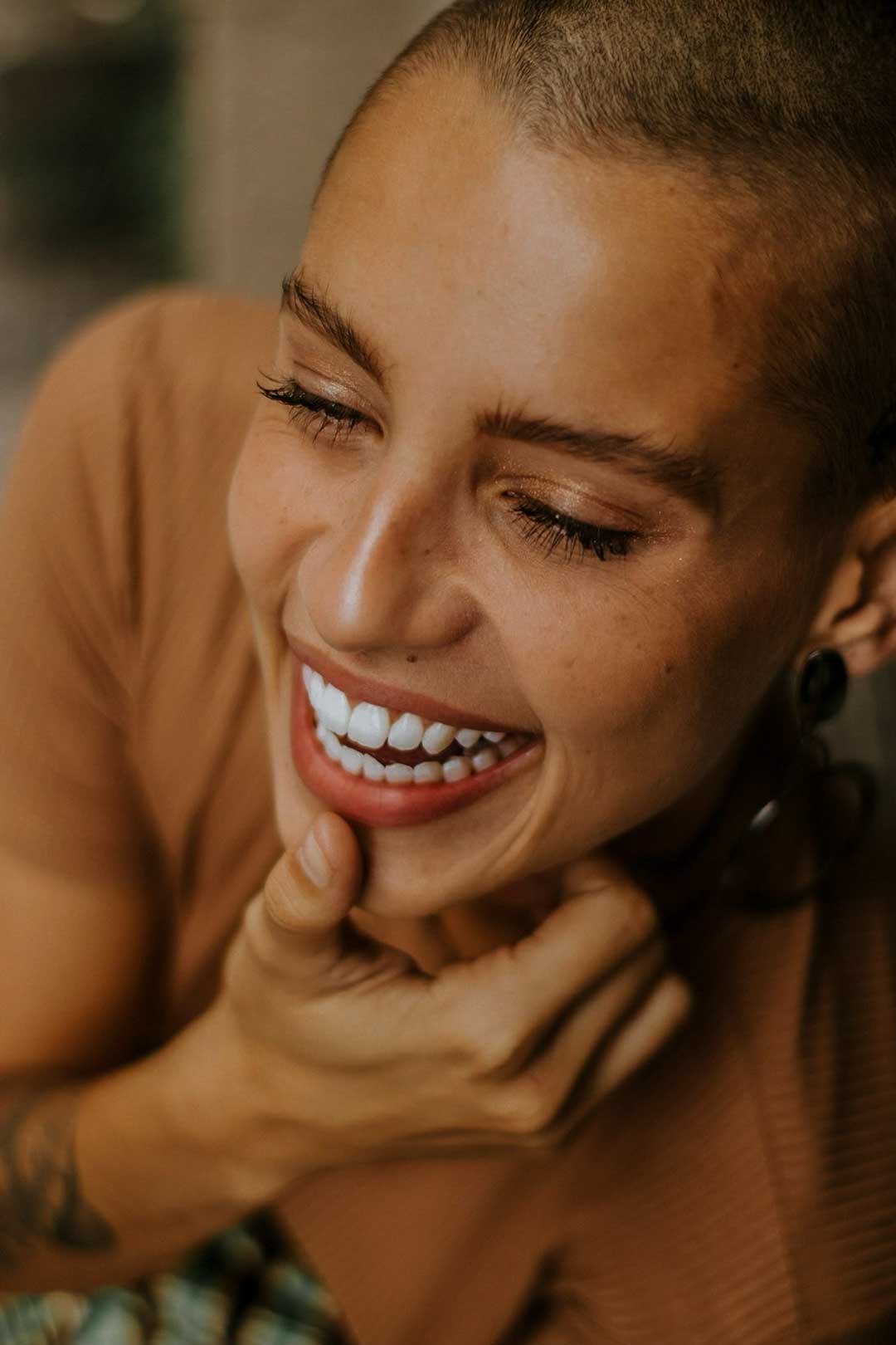 Hollywood Smile Makeover in Dubai