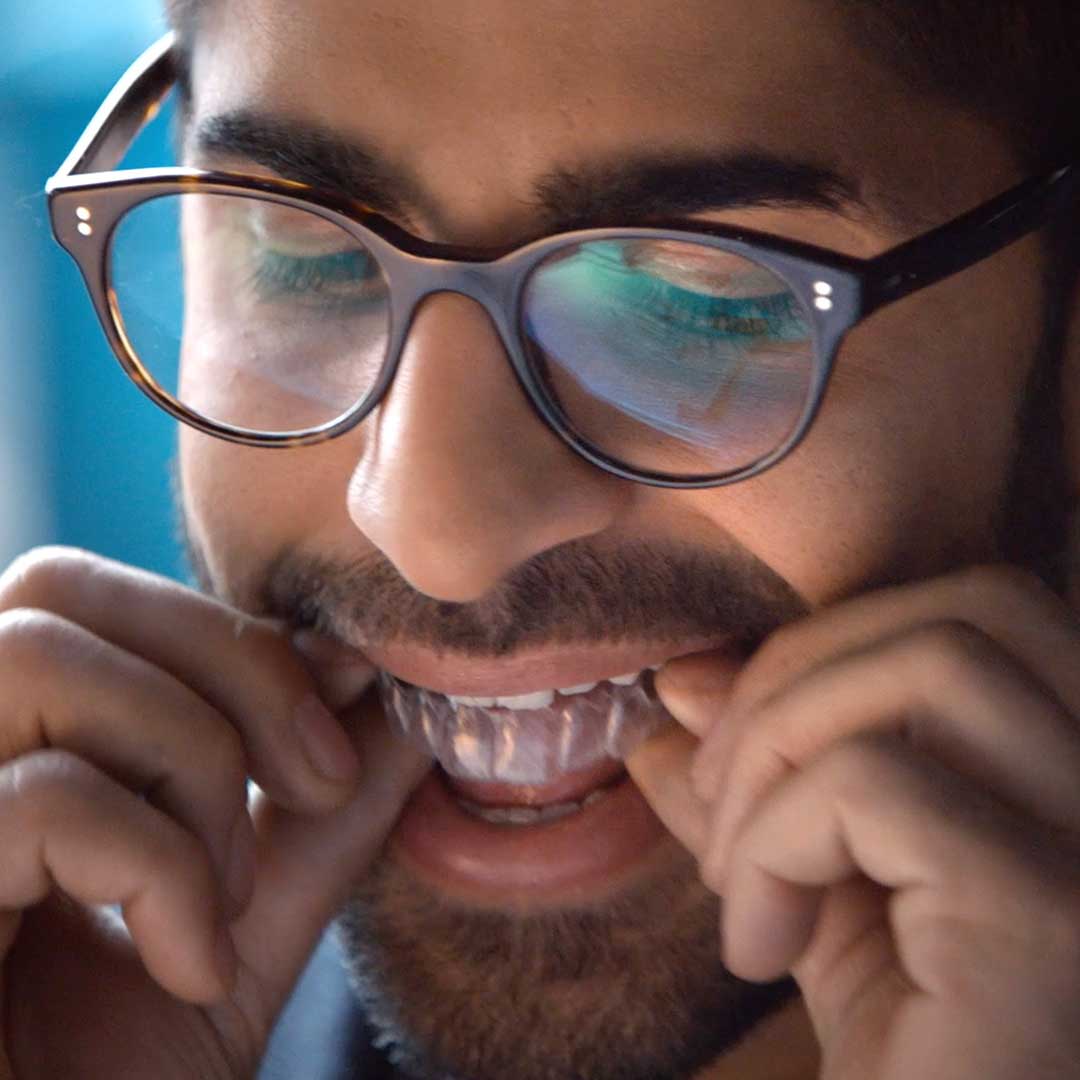 Invisalign Clear Aligners