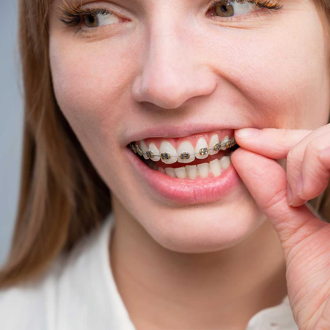 Dental Emergency
