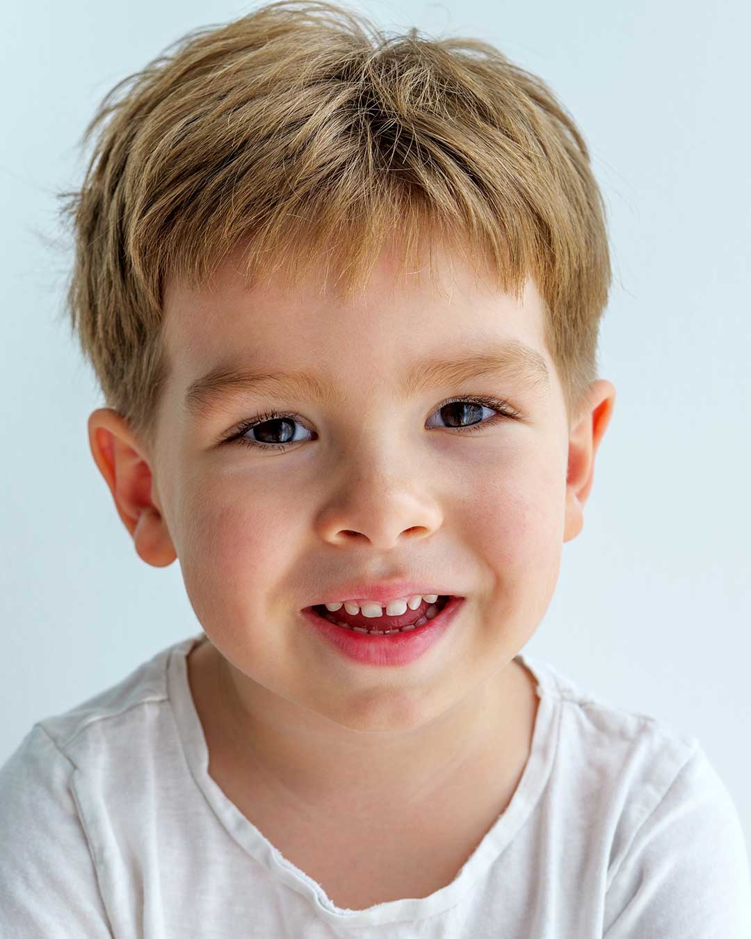 Composite Crowns for Children