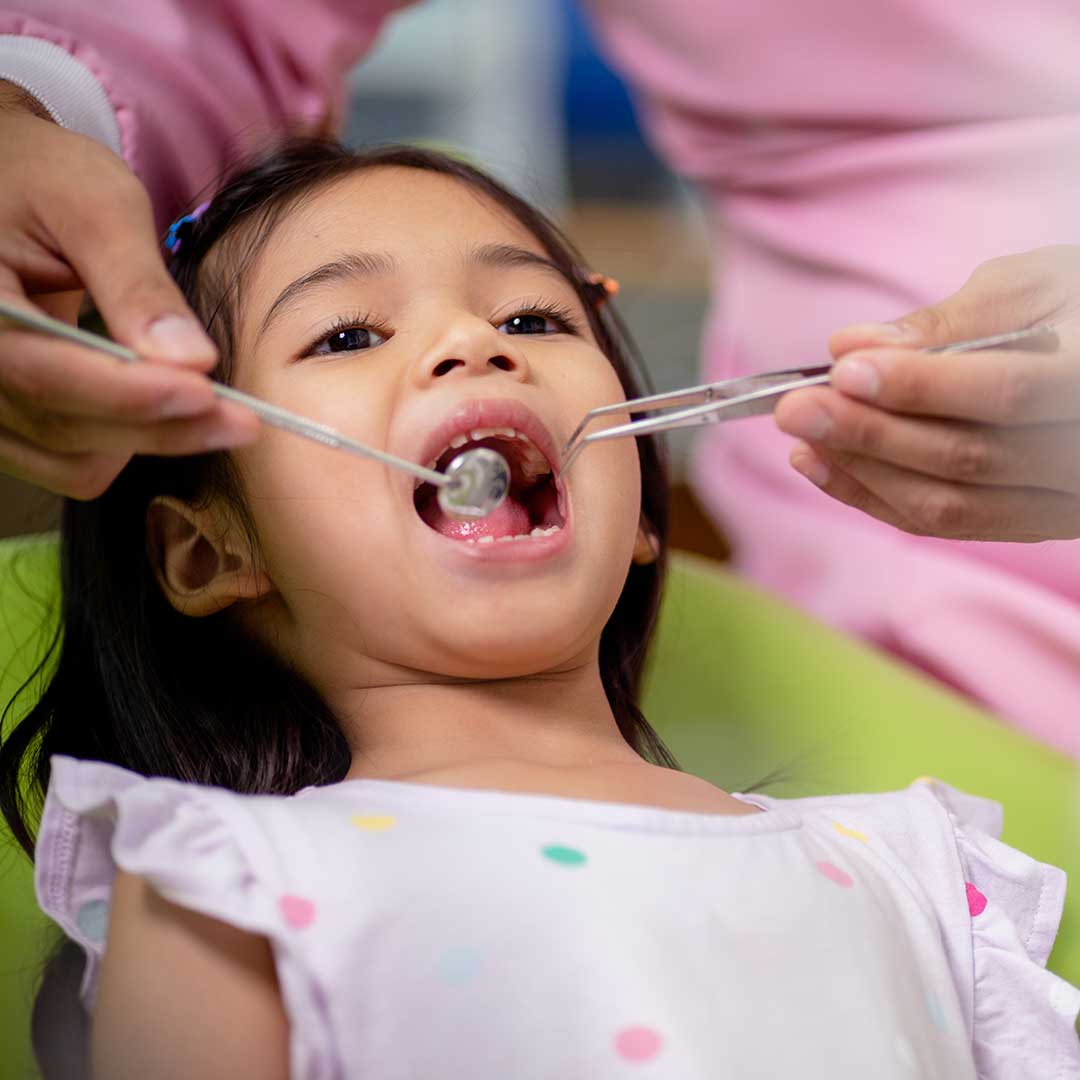 Pulpotomy for Children