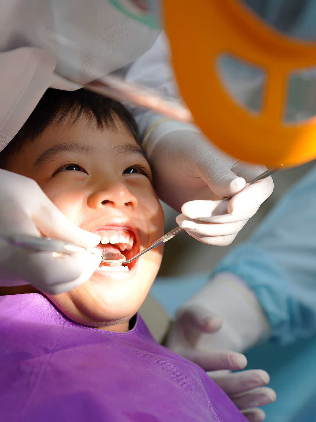 Zirconia Crowns for Children