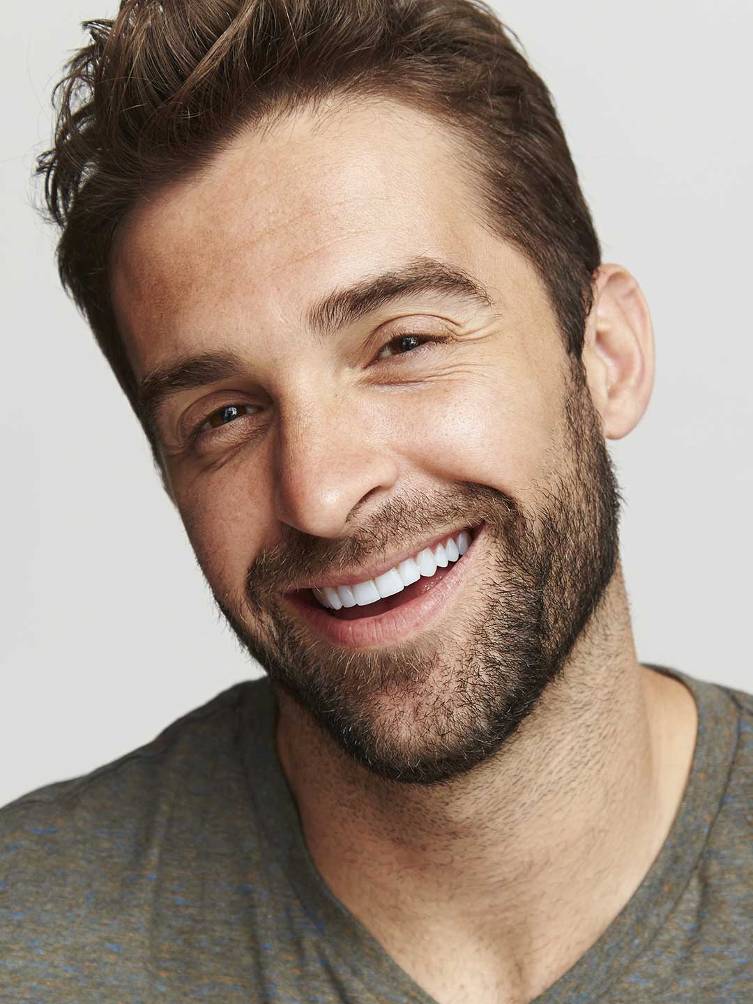Porcelain Veneers in Dubai